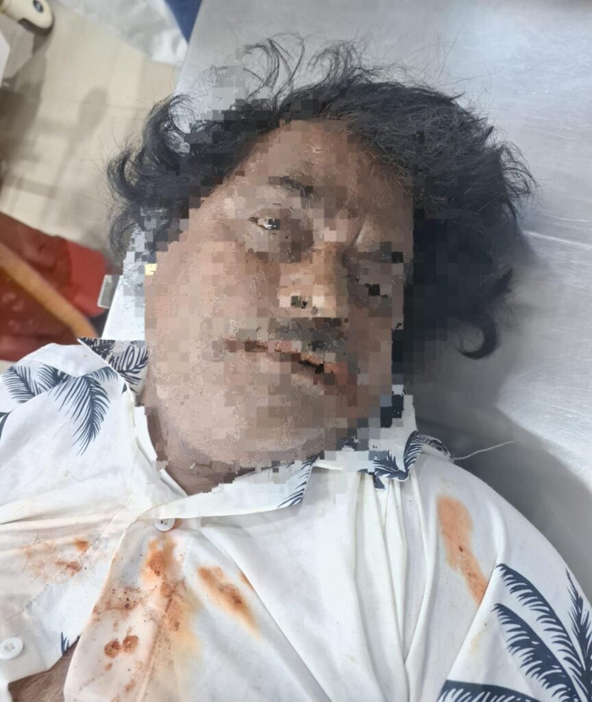 गाजीपुर : पोस्टमार्टम करने वाला चंद्रशेखर की हुई मौत 2 img 20250328 wa02648482869917212113328